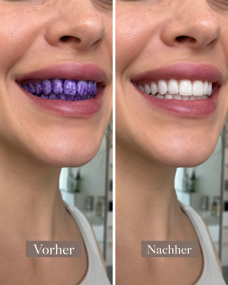 SmilesBright Vorher Nachher