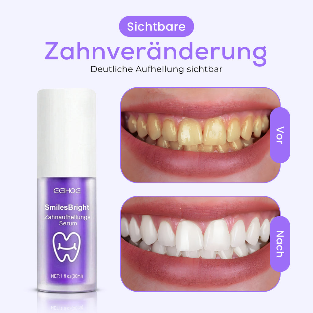 Zahnaufhellungs Serum - Für sichtbar weißere Zähne