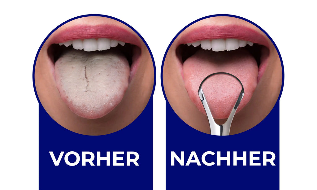 Ultra Zungenreiniger aus Edelstahl